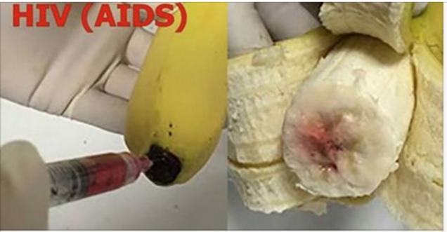HIV infected Blood banana Aids virus – HOAX