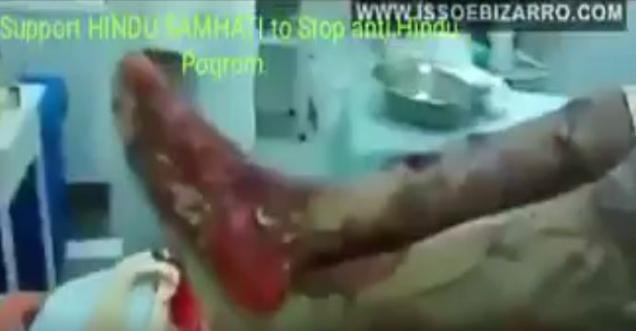Fact check, Hindu Rajesh in Kerala hands chopped off, stabbed 40 times news correct, video wrong
