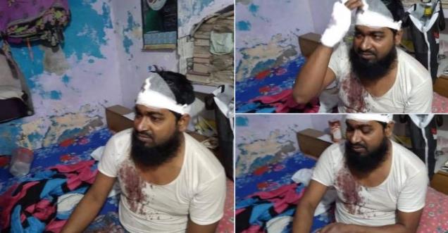 Was Imam Hafiz Adnan of Lucknow’s mosque was attacked by Sanghs-Bajrangs