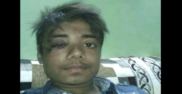 Was a student beaten up while celebrating the win of Pak in T20