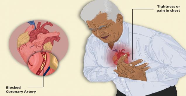 Top 10 Foods to Clean Your Arteries that Can Prevent a Heart Attack