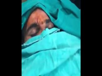 Mohammed Shami unconscious Video after accident